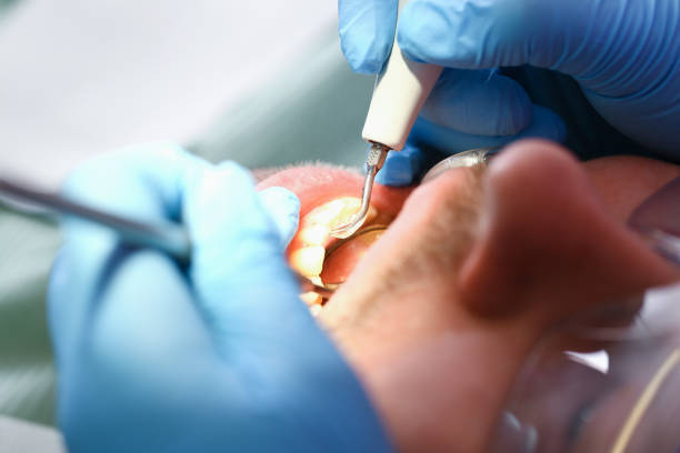 Best After-Hours Emergency Dentist in Escatawpa, MS