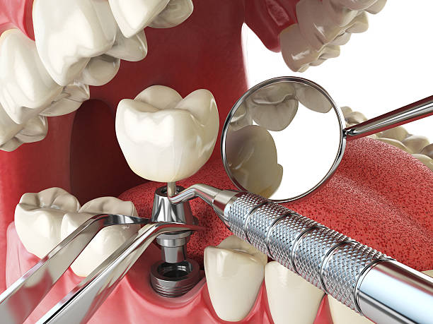 Best After-Hours Emergency Dentist in Escatawpa, MS